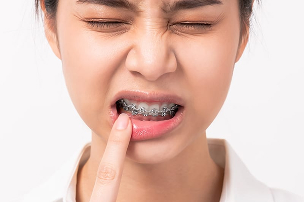 orthodontic emergency care in glendale