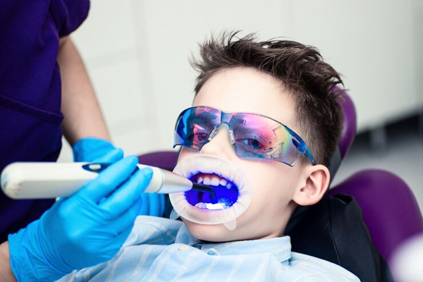 teeth whitening in glendale