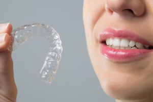 what is invisalign clear aligners