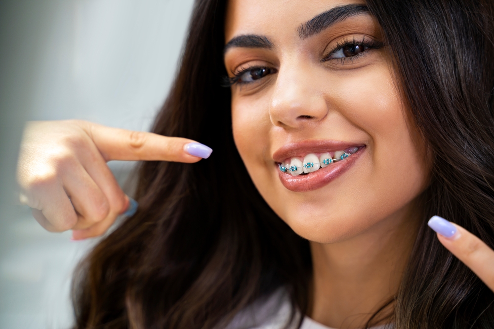 When Should Kids Start Wearing Braces? Understanding the Ideal Age