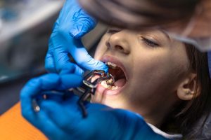 top questions parents ask about kids dental treatments expert